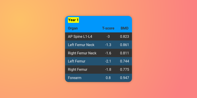 screenshot of a BMD report classified by Bone Health Tracker