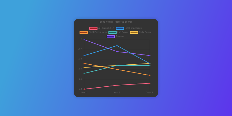 screenshot of a Z-score chart visualization in Bone Health Tracker